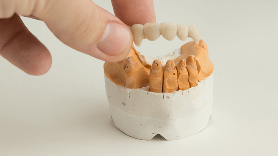 What are the pros and cons of dental crowns?
