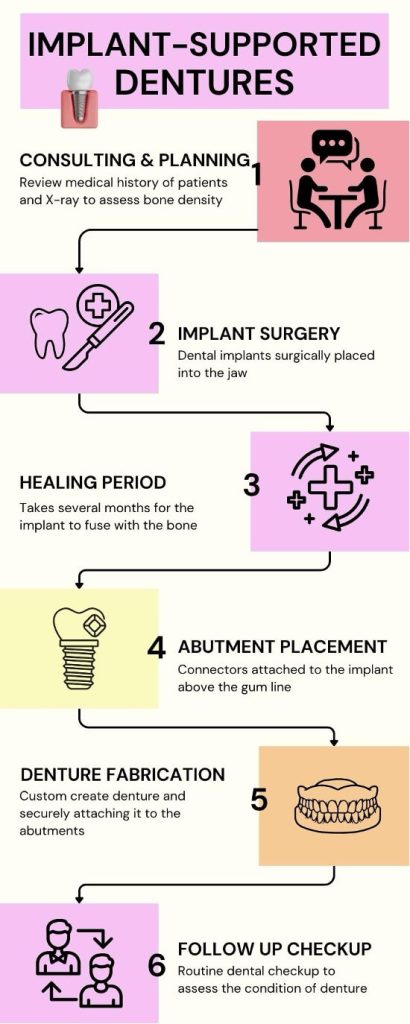 Implant-Supported Dentures