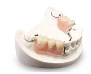 Partial Dentures