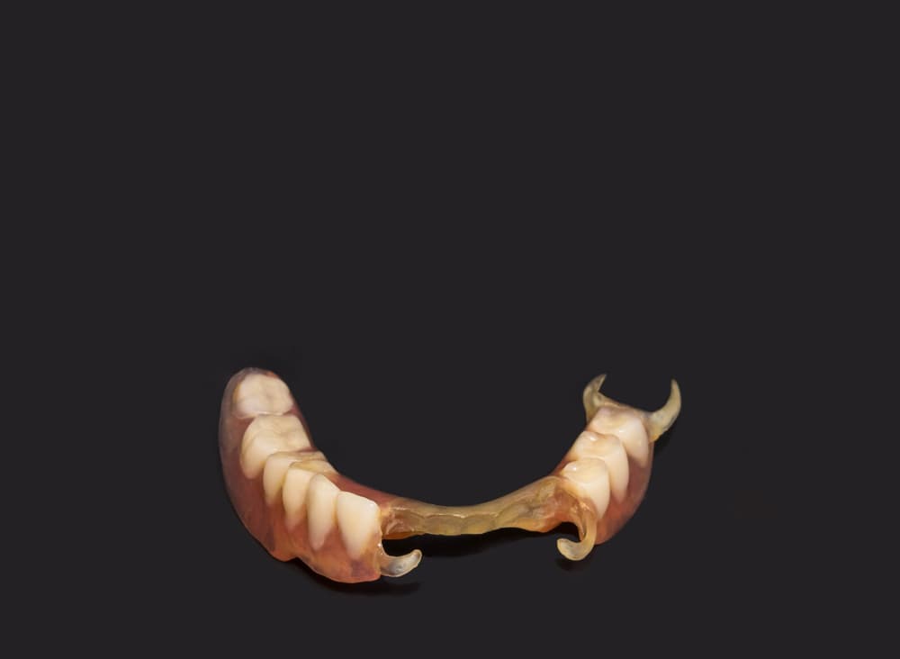 flexible-partial-dentures